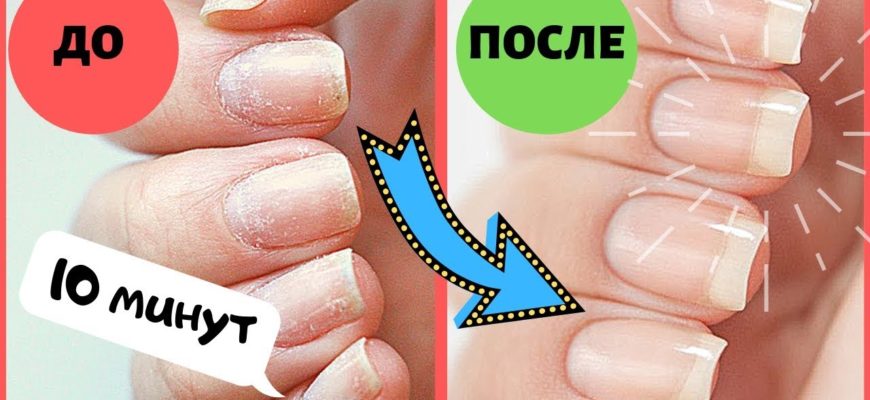 kak vosstanovit nogti posle gel laka