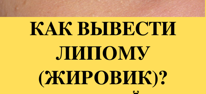 kak vyvesti lipomu zhirovik samyj effektivnyj metod narodnoj mediciny