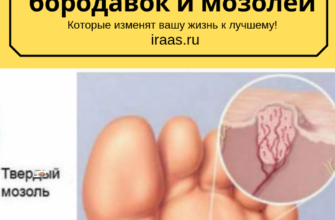 luchshee sredstvo kotoroe vmig izbavit ot nadoevshih borodavok i mozolej