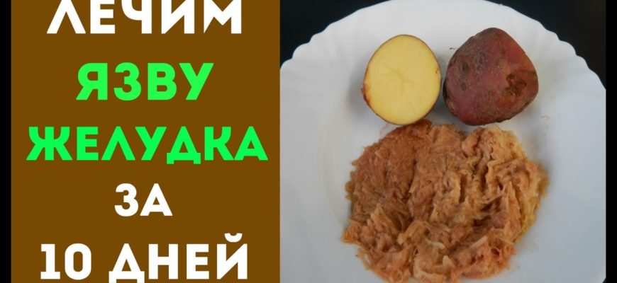 prostye produkty pomogut vylechit yazvu